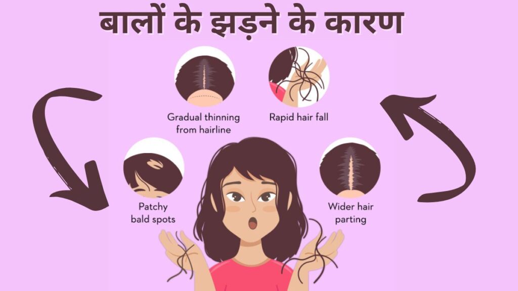 बालों के झड़ने के कारण