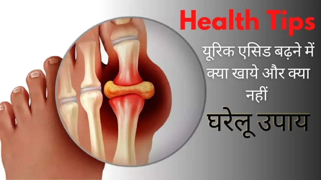 Diet Tips to Control Uric Acid