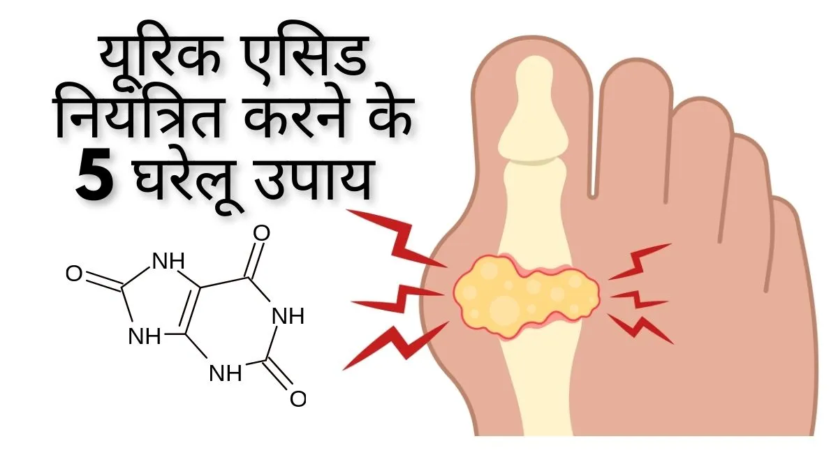 Home Remedies For Uric Acid Control in Hindi