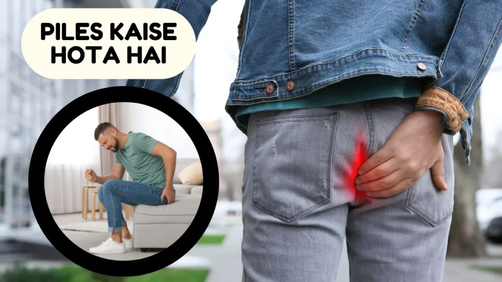 Piles Kaise Hota Hai