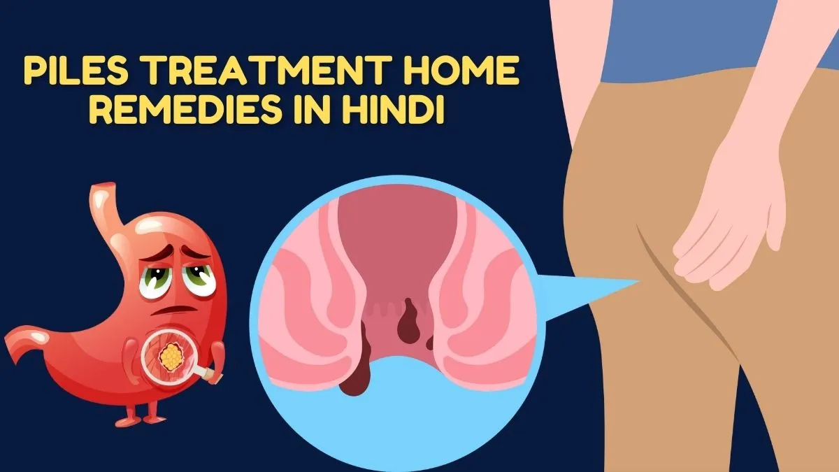 Piles Treatment Home Remedies In Hindi