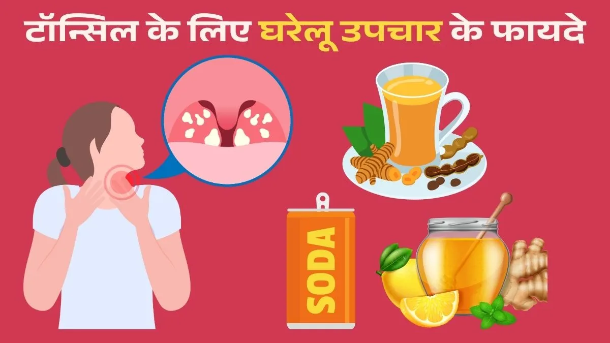 home remedies for tonsillitis